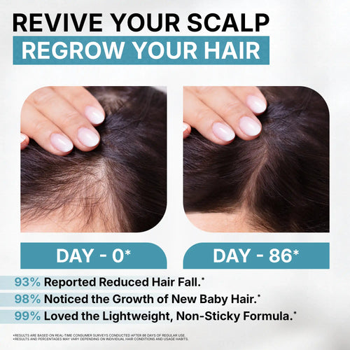 Advertisement showing scalp before and after use with text about hair regrowth and scalp revival.