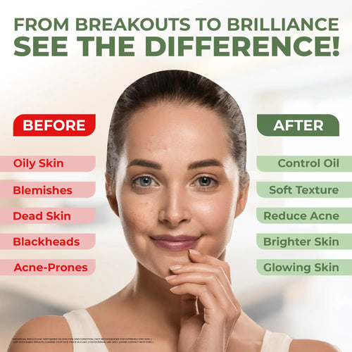 Before and after skin improvement chart highlighting benefits like oil control, soft texture, reduced acne, brighter and glowing skin for Lavaya Salicylic Acid Face Wash users