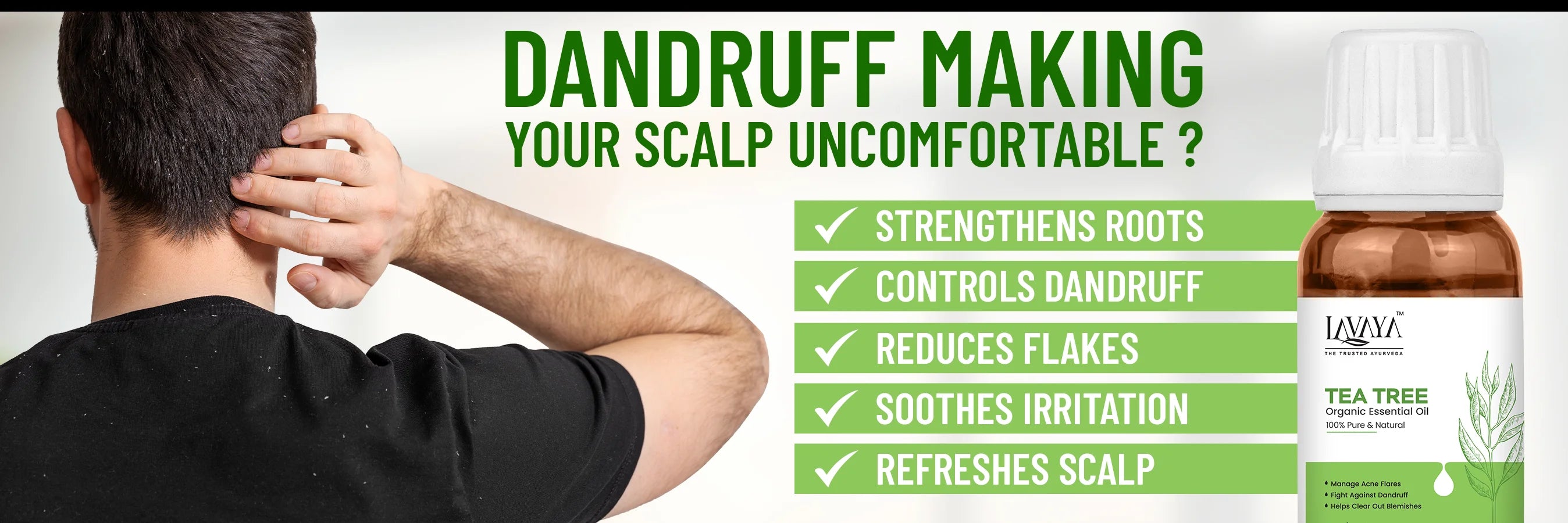 Say Goodbye to Dandruff