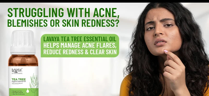 Tea Tree for Acne Relief