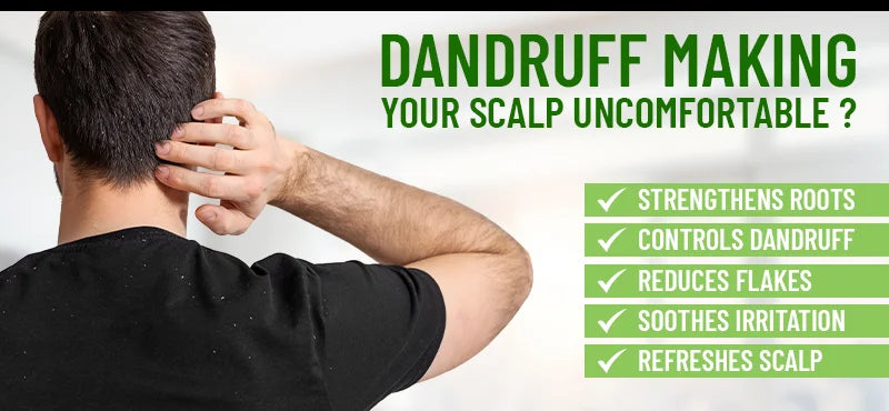 Say Goodbye to Dandruff